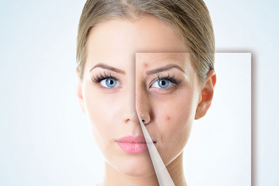 Discover Nearby Intense Pulsed Light Therapy: Skin Renewal post thumbnail image