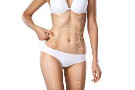 Navigating Your Tummy Tuck Journey in Miami post thumbnail image